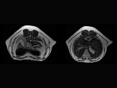 T2W abdomna psa z respiratornim proženjem